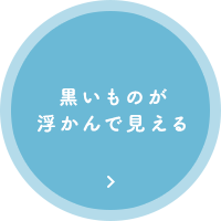 黒いものが浮かんで見える